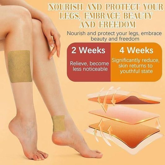 Spider & Varicose Vein Patches | Natural Herbal Therapy for Swelling, Fatigue & Vein Health
