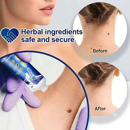 Wart Remover Gel for Man / Woman (Buy 1 Get 1 Free)