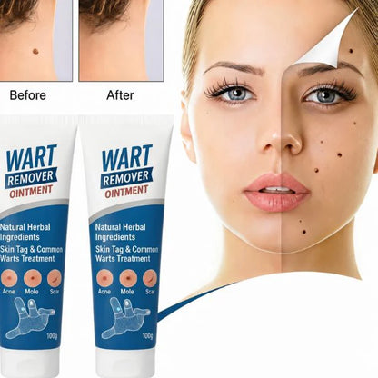 Wart Remover Gel for Man / Woman (Buy 1 Get 1 Free)